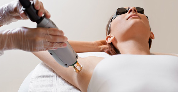 laser-hair-removal