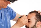 Hair-Transplant-Surgery